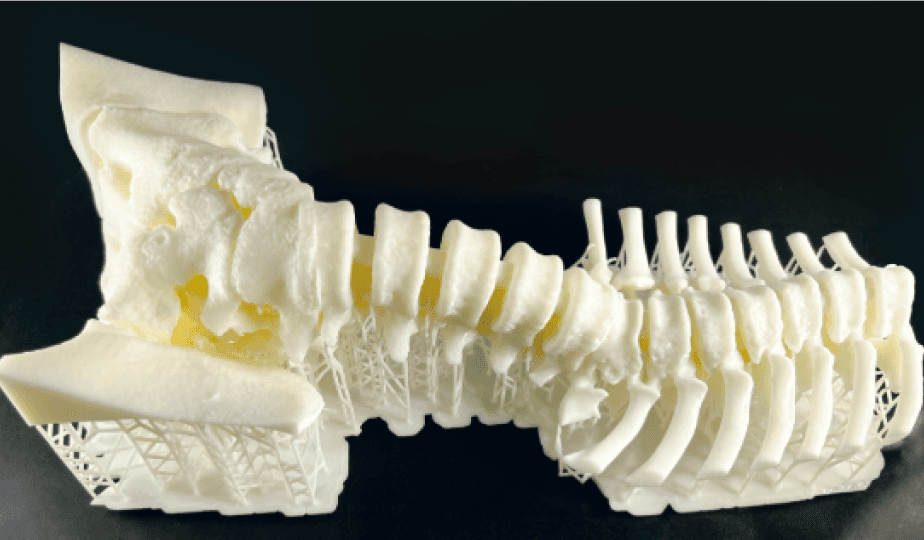 医療用3Dプリント事例