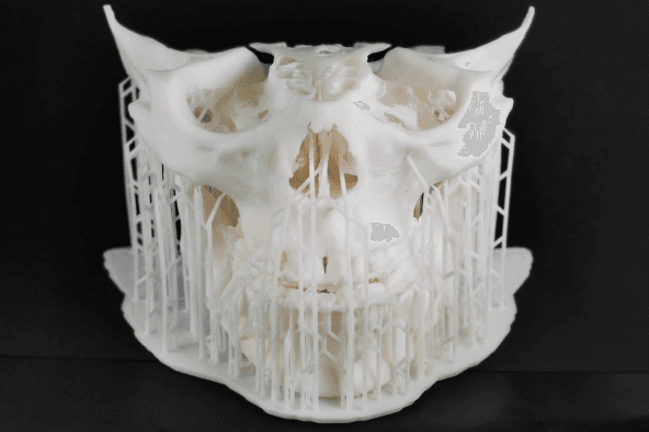 ノイズ除去＋3Dプリント事例