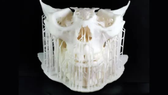 SmaPri Sonic (スマプリソニック) detail 1